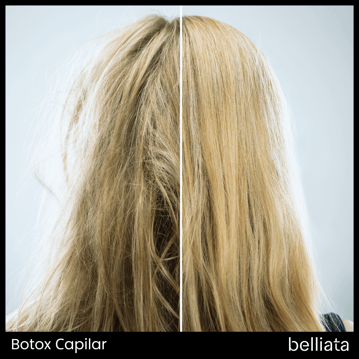 Botox Capilar - Todo lo Que Debe Saber | belliata.es